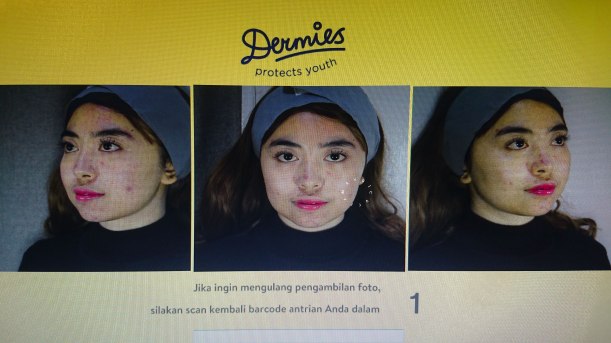 dermies-clear-acne-10.jpg